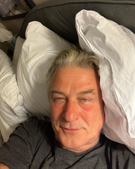 Operatorun faciəvi şəkildə öldüyü filmin çəkilişləri başa çatdı - FOTO