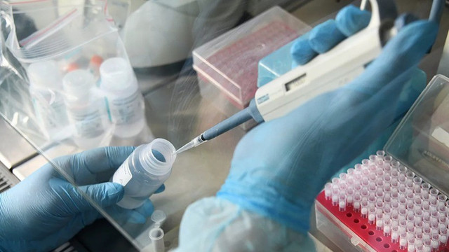 Çin Azərbaycana koronavirus test dəsti təqdim etdi