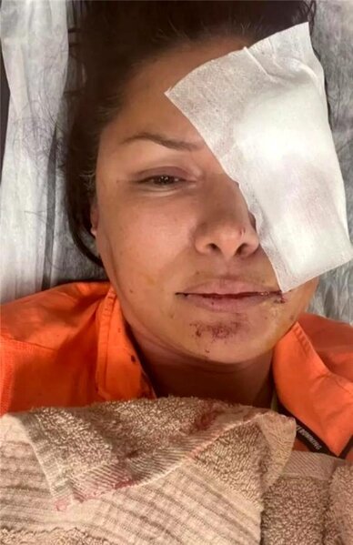 Tanınmış model itin hücumuna məruz qaldı: Son halı görənləri kədərləndirdi