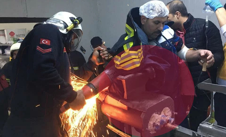 Ani diqqətsizlik nəticəsində qolundan olacaqdı - FOTO