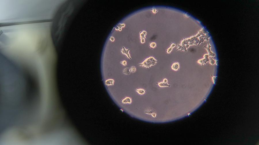 Alimlər koronavirus peyvəndini öz bədənlərində sınayıblar - İDDİA