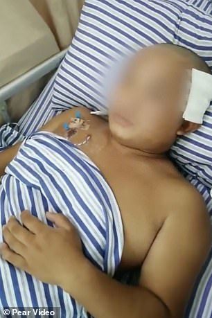 Gəncin beynindən orada 17 il yaşamış canlı qurd çıxarılıb - FOTO/VİDEO