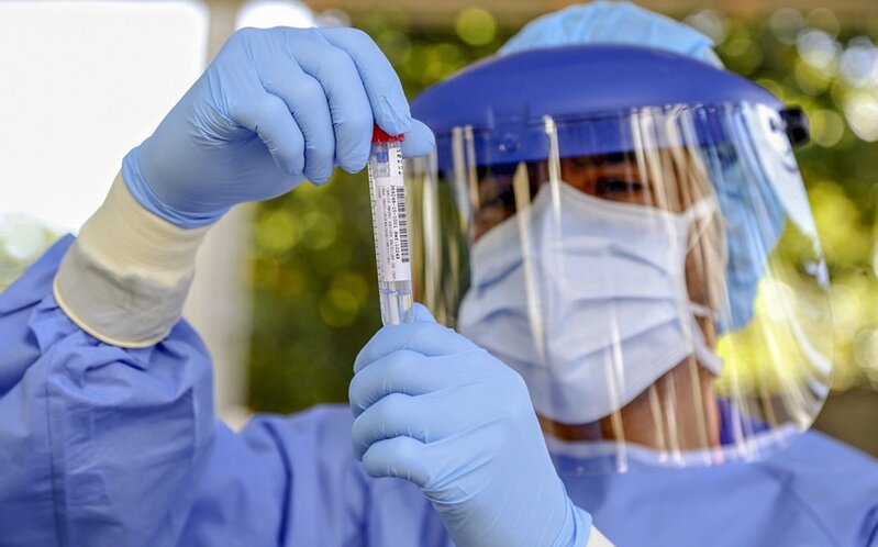 Azərbaycanda koronavirusa yoluxanların bu günə olan statistikası