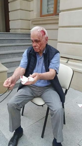 Rəhim Qazıyevin döyülməsi ilə bağlı cinayət işi başladılıb - FOTO