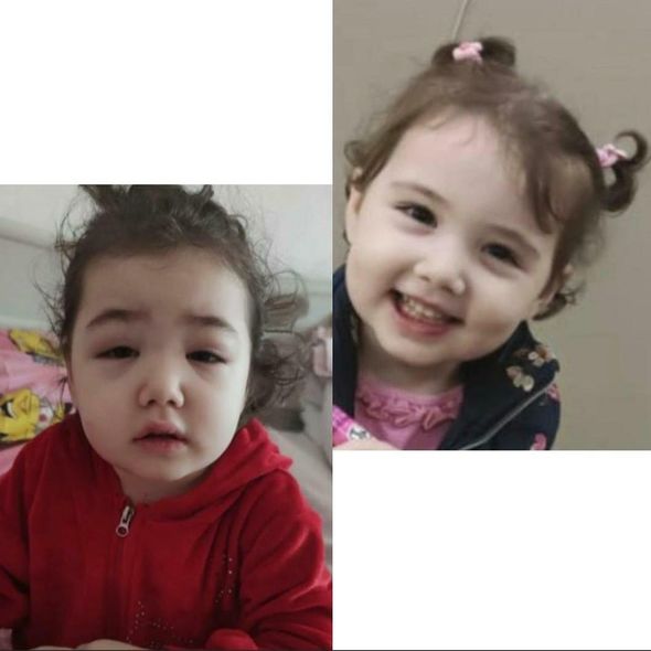 Üç yaşlı İncinin təcili olaraq yardıma ehtiyacı var - FOTO