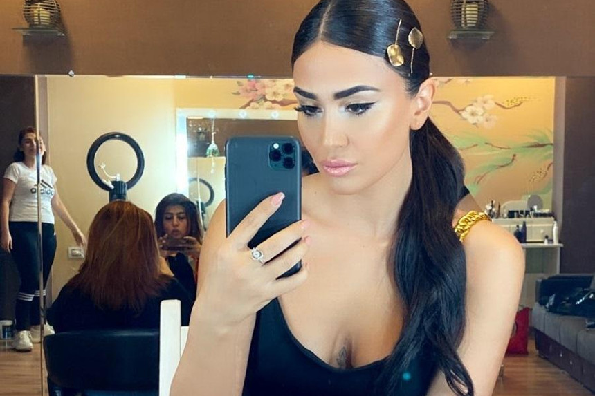 Pərvin Abıyeva bu dəfə dodaqlarını böyütdü - FOTO