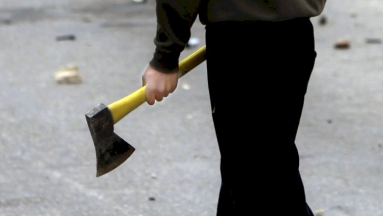 Cəlilabadda əmisinin baltaladığı uşaqlardan biri öldü - YENİLƏNİB