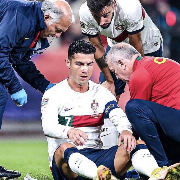 Ronaldu rəqib qapıçı ilə toqquşmadan sonra ciddi xəsarət aldı - FOTOLAR