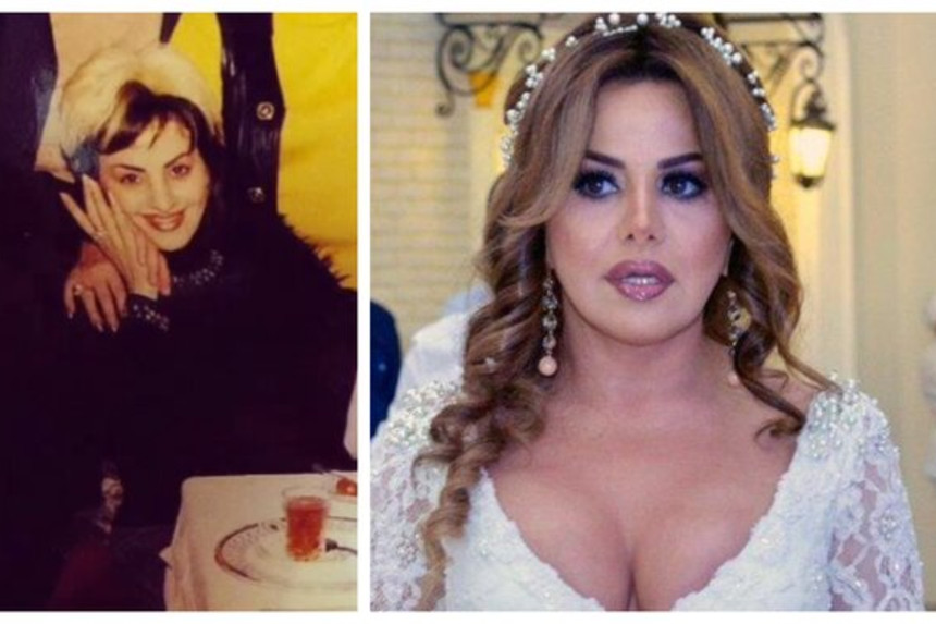Mətanət Əsədovanın illər öncəki fotosu hər kəsi TƏƏCCÜBLƏNDİRDİ