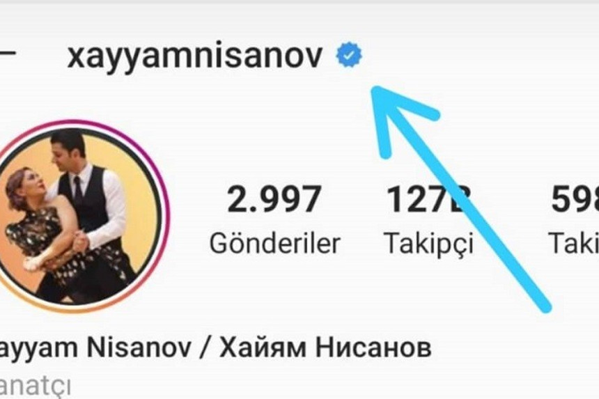 "İnstagram" daha bir azərbaycanlı müğənnini tanıdı - FOTO