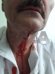 Rusiyada qohumu xəstəxanada öldüyü üçün ermənilər HƏKİMLƏRİ DÖYDÜLƏR - FOTO/VİDEO