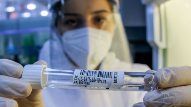 Azərbaycanda koronavirusa yoluxanların bu günə olan statistikası - 5 nəfər öldü