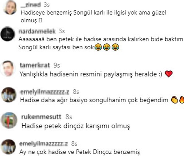 Məşhur müğənni son halı ilə Hadisəyə bənzədildi – FOTO