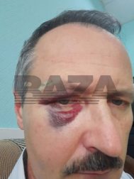 Rusiyada qohumu xəstəxanada öldüyü üçün ermənilər HƏKİMLƏRİ DÖYDÜLƏR - FOTO/VİDEO