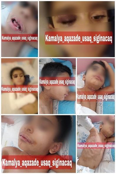 Narkotik çəkib, 5 yaşlı uşağına işgəncə verən ana həbs edildi