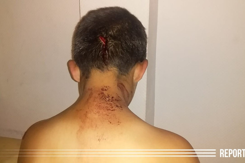 Ata dilənmək istəməyən 11 yaşlı oğlunu başından bıçaqladı - FOTO