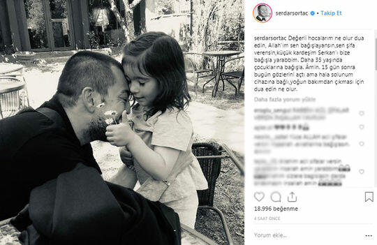 Serdar Ortaça ağır itki üz verdi - FOTO