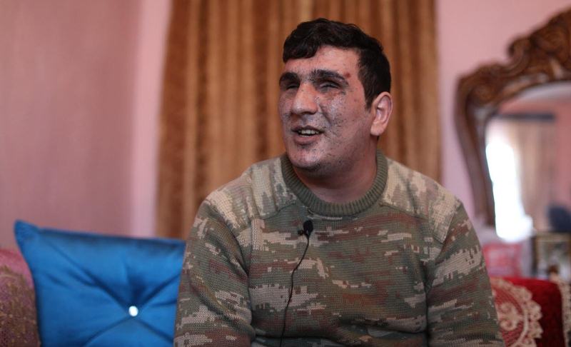 Vətən müharibəsində iki gözünü itirən qazimiz: "Mənə kömək göstərilsin, ailəmin üzünə baxa bilim