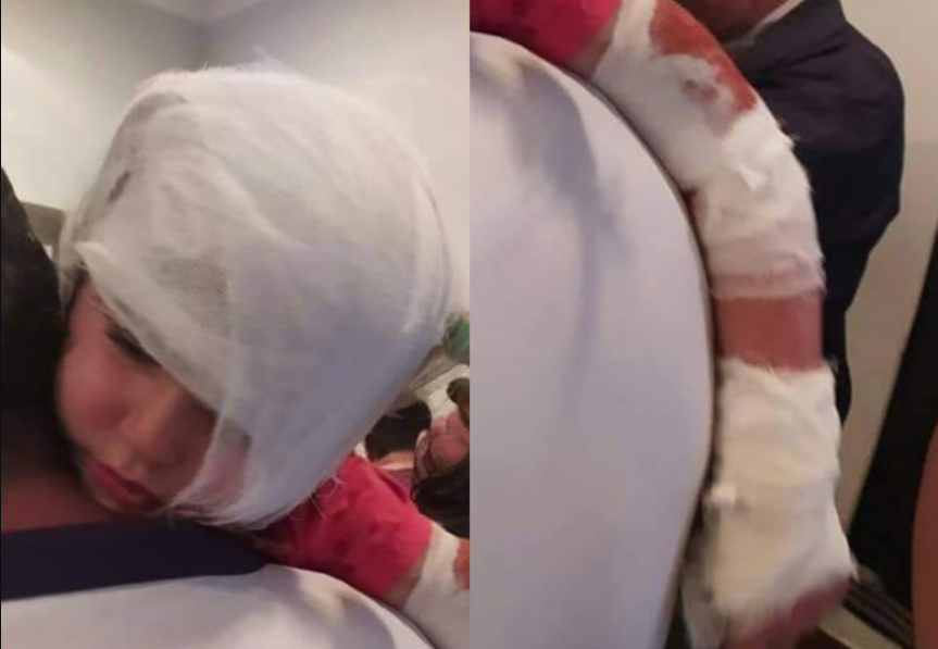 Xaçmazda itin dişlədiyi uşaq Bakıya göndərildi - FOTO