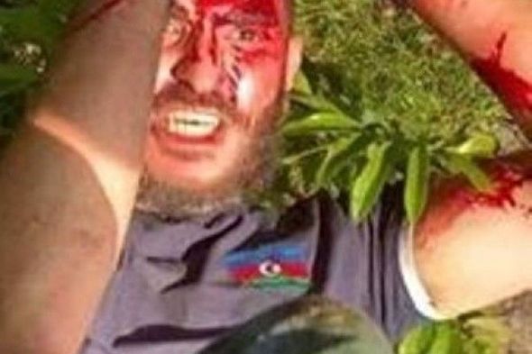 Toğrul Qafarlı Belçikada erməni təcavüzü barədə: "Biz hər cür təxribata hazır idik, amma beləsinə yox
