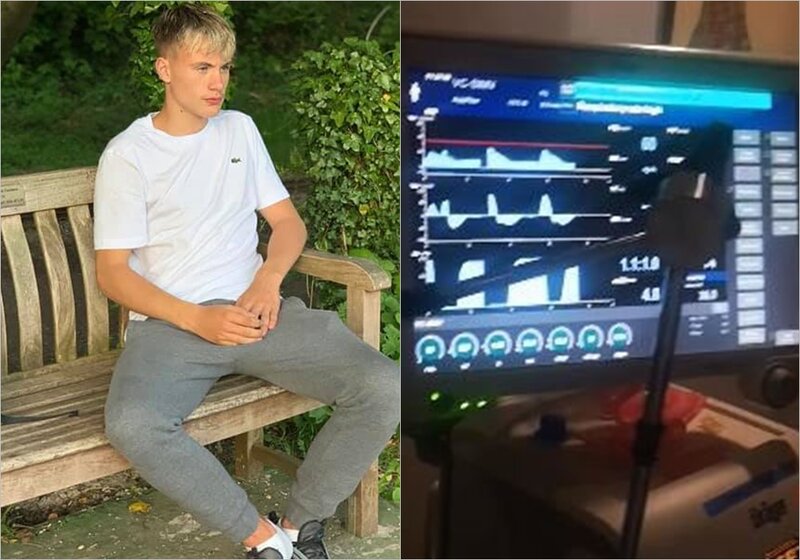"Ölmüş" gənc orqanları bağışlandıqdan sonra "dirildi" - FOTO/VİDEO