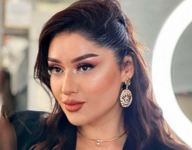 Nərmin Kərimbəyova avtomobil qəzasına düşüb