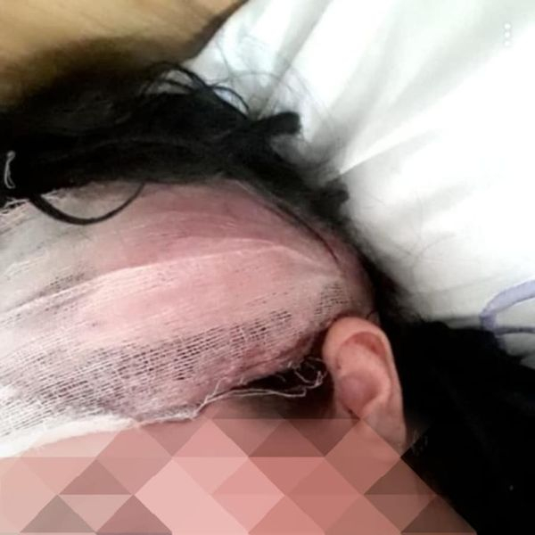 Azərbaycanda 15 yaşında ərə verilən qız həyat yoldaşı və qayınanası tərəfindən döyülürmüş - FOTO