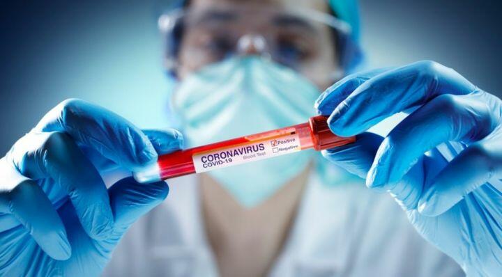 İranda son sutkada koronavirusdan 41 nəfər öldü