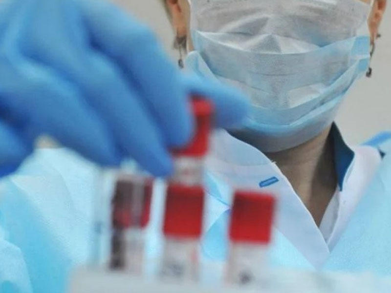 Koronavirus bu yolla da insanları yoluxdurur - həkim açıqladı