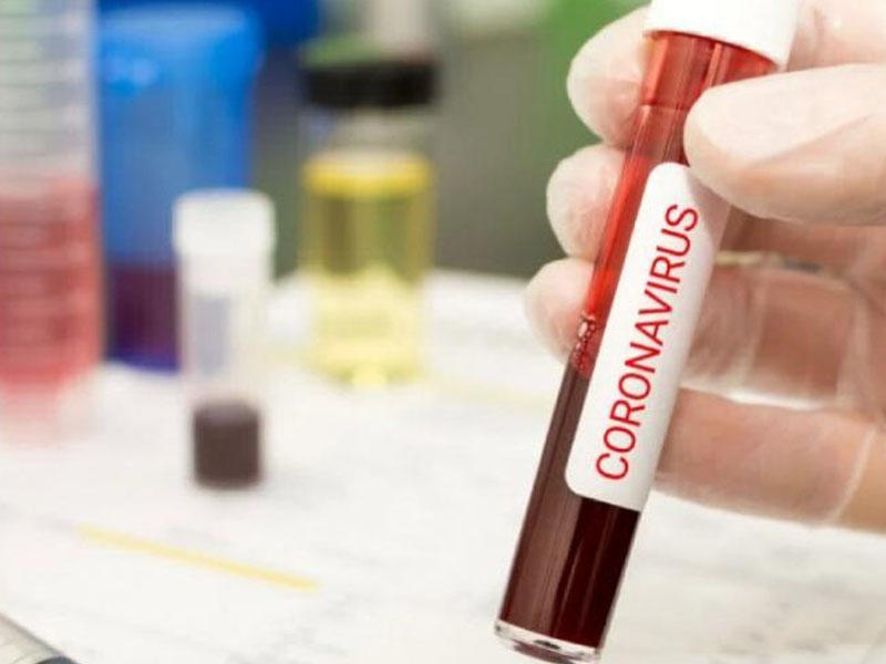 "Xaş, kəllə-paça hara, koronavirus hara?"- Azərbaycanlı professordan antivirus qida SİYAHISI
