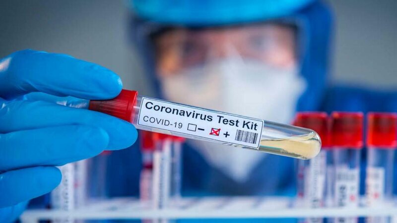 Rusiyada koronavirus daha 575 nəfəri öldürdü