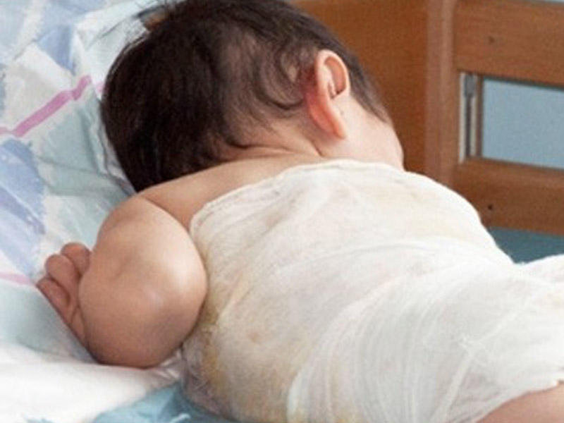 13 aylıq körpə koronavirusdan sağaldı